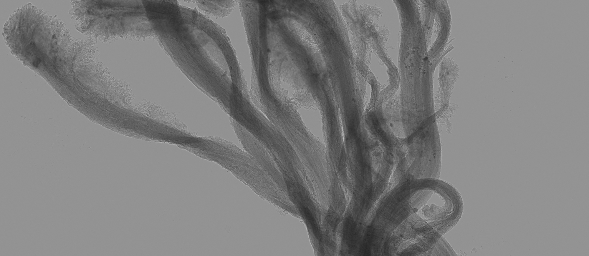 Insurgency of Life (X-ray), 2019