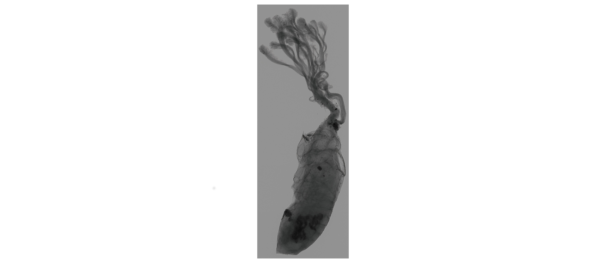 Insurgency of Life (X-ray), 2019